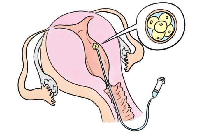 北京艾滋病试管机构有哪些医院_北京艾滋病检测多少钱一次！