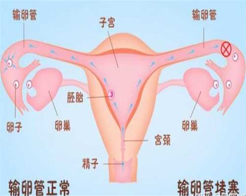 北京代生价格明细,北京个人有偿捐卵联系方式,成都有偿捐卵联系方式