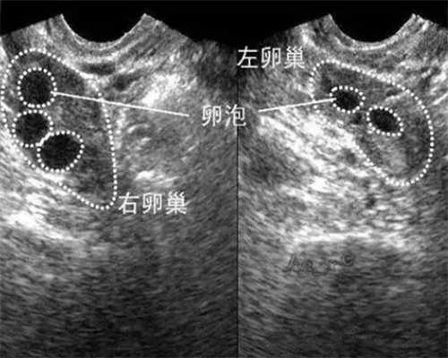 北京最靠谱代孕机构,「难以割舍」北京试管价格